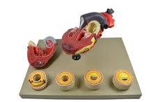 Load image into Gallery viewer, Heart: Heart Condition Model